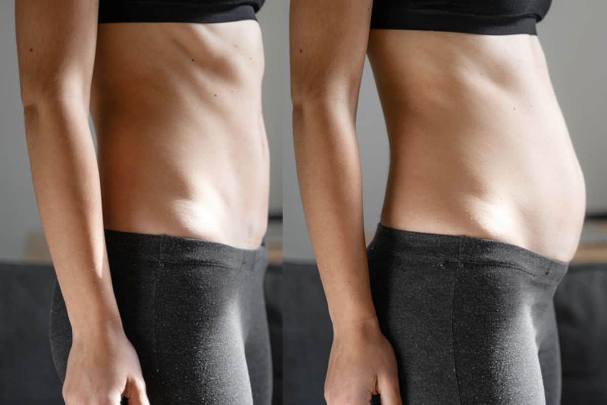 How long does diastasis recti take to improve Newark-on-Trent?