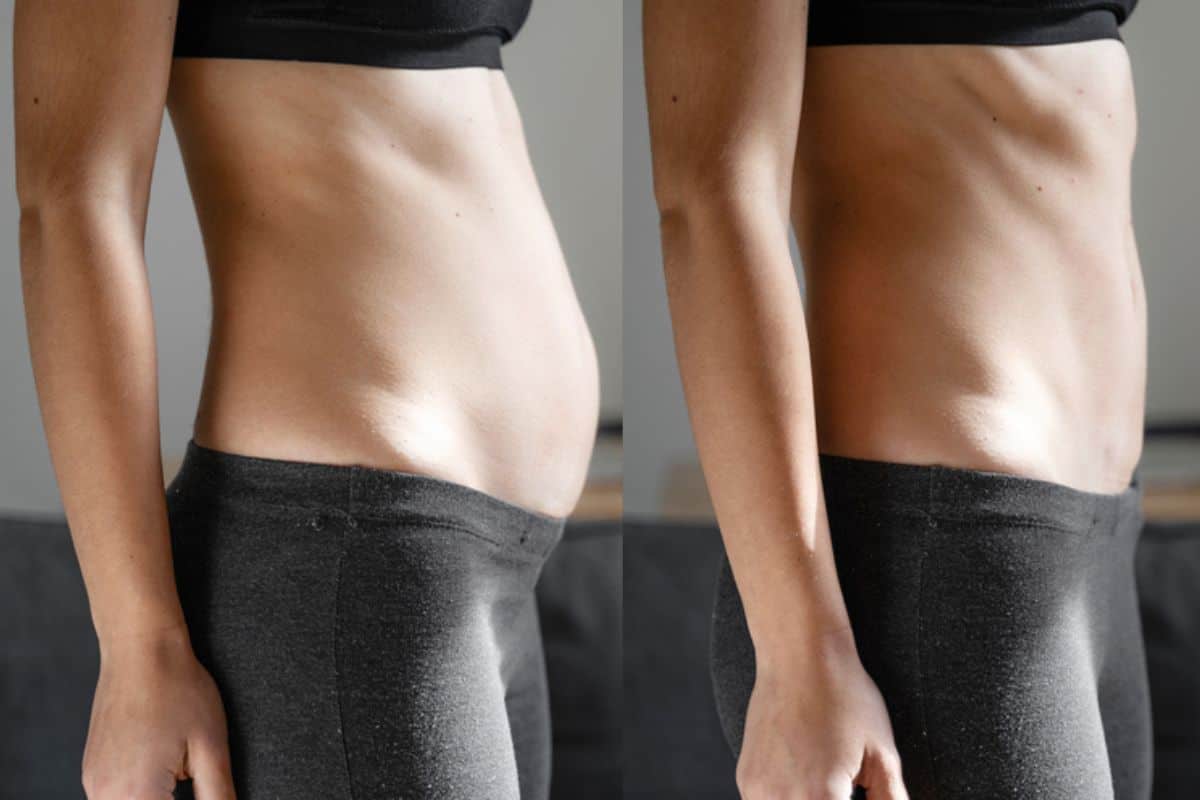 Post-Pregnancy: What Happens to Your Abdominal Muscles After Birth Newark-on-Trent