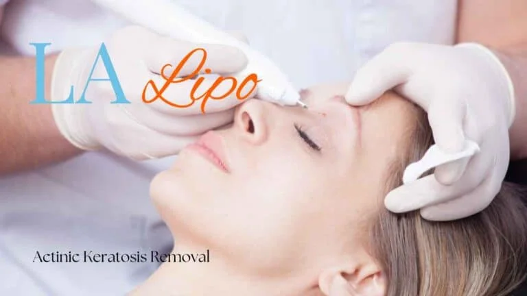 Woman receiving Actinic Keratosis Removal Treatment Newark-on-Trent