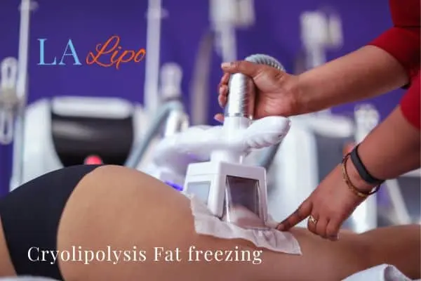 women getting fat freezing Newark-on-Trent