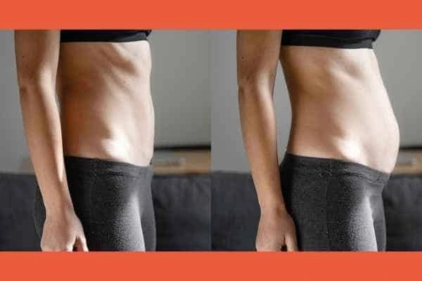 LA-EMS Body Sculpting results Newark-on-Trent