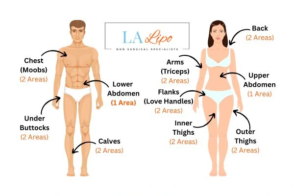 LA LIPO Cryolipolysis Areas Newark-on-Trent