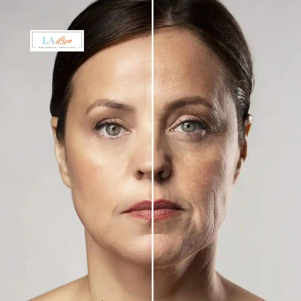 How Can You Tell If Non-Surgical Skin Tightening Is Right for You Newark-on-Trent?