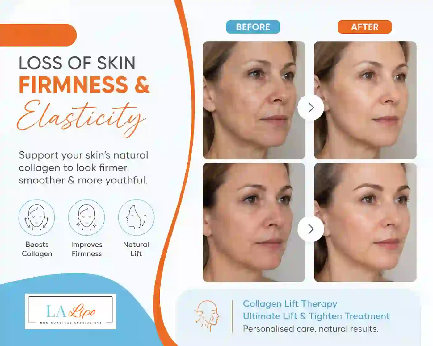 Sign #7: Loss of Skin Firmness and Elasticity Newark-on-Trent