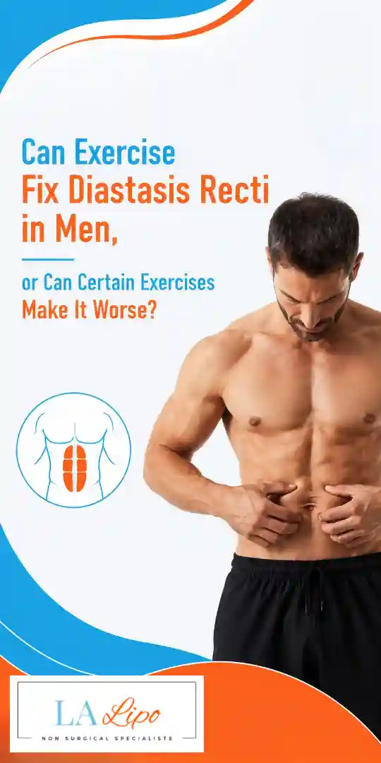 Can Exercise Fix Diastasis Recti in Men, or Can Certain Exercises Make It Worse Newark-on-Trent?